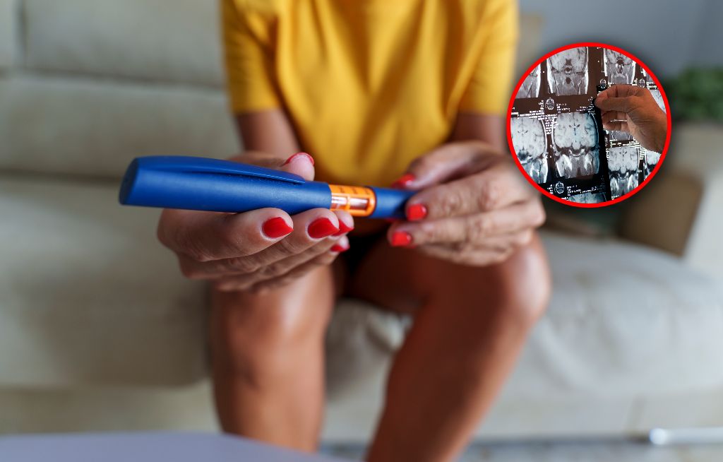 Zaskakujące badania dot. leków na cukrzycę. Tak wpływają na mózg