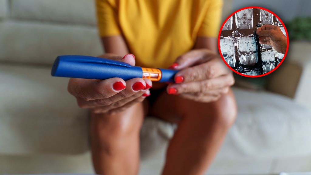 Badacze przeanalizowali dane dotyczące ponad 450 tys. osób