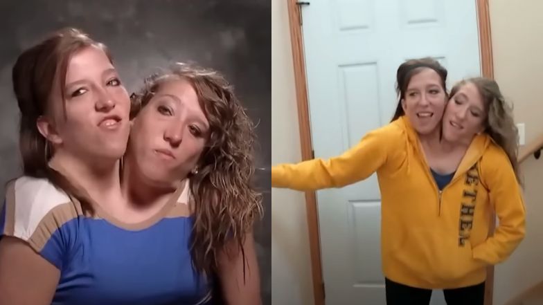 Abby i Brittany Hensel mają jedno wynagrodzenie