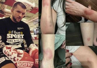 Była dziewczyna zawodnika MMA OSKARŻA GO O POBICIE. "Ona ma OBSESJĘ NA MOIM PUNKCIE"