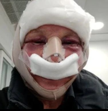 Lekarz zapewniał Pete'a, że z czasem wszystkie dolegliwości ustąpią