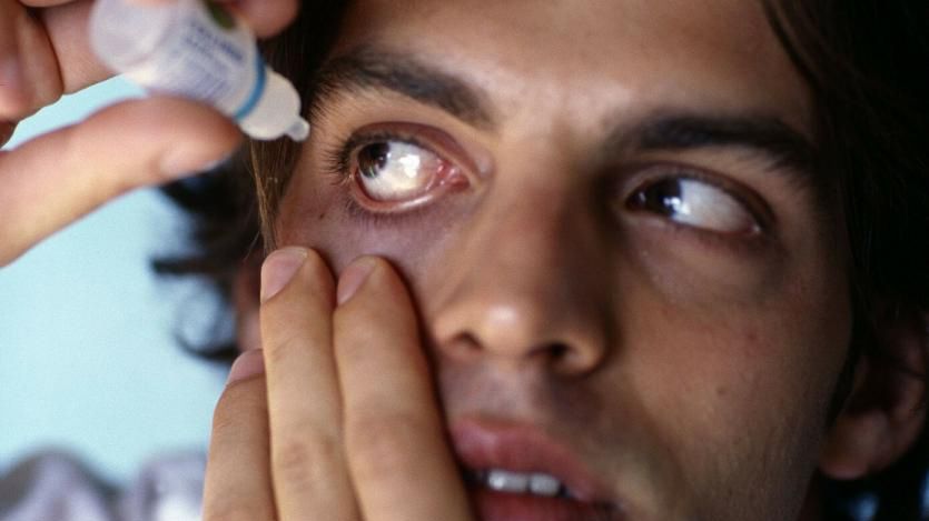 Przekrwione oczy mogą oznaczać chorobę. Nie przegap tych objawów