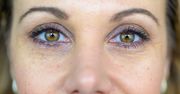 Wklep w skórę wokół oczu. Kosztuje 10 zł i działa niczym botoks