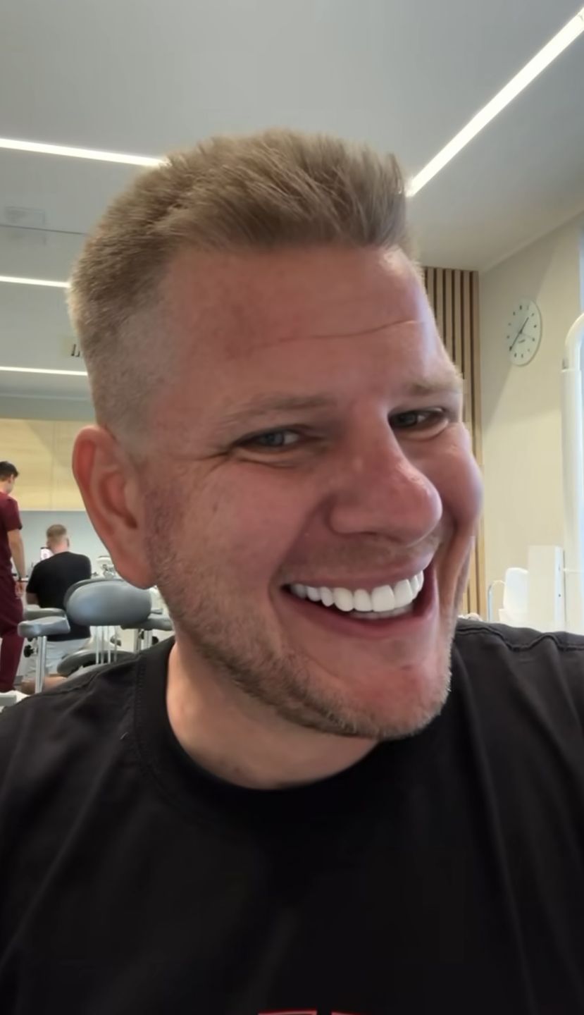 Filip Chajzer ma "nowe zęby"