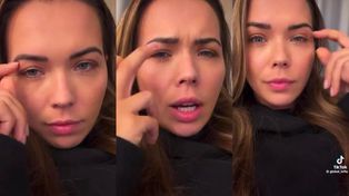 Sandra Kubicka objaśnia fanom, czemu robi sobie operację powiek: "PRACUJĘ SWOIM WIZERUNKIEM"