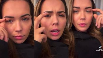 Sandra Kubicka objaśnia fanom, czemu robi sobie operację powiek: "PRACUJĘ SWOIM WIZERUNKIEM"