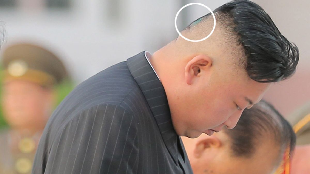 Na głowie dyktatora zauważono tajemnicze znamię