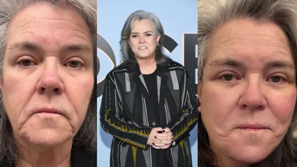Rosie O’Donnell ujawnia, ile kosztował ją lifting twarzy
