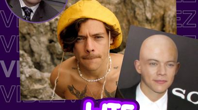 Harry Styles to scamer? Fani twierdzą, że jest ŁYSY