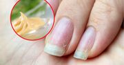 Nałóż produkt z lodówki na paznokcie i zaczekaj. Niesamowity efekt
