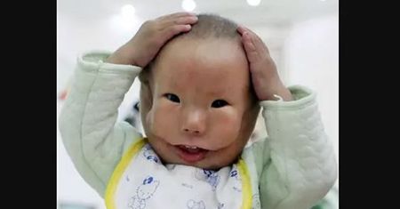 Urodził się ze zdeformowaną twarzą. Ludzie przezywali go "mask boy"