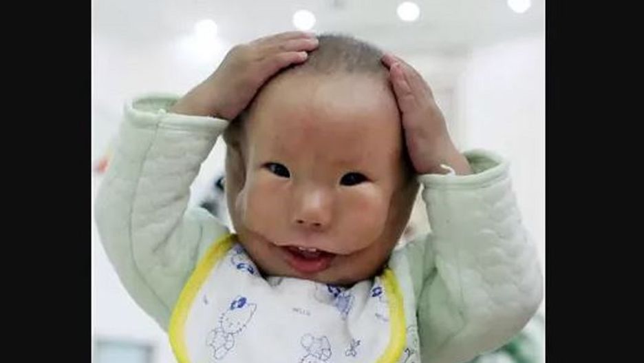 Urodził się ze zdeformowaną twarzą. Ludzie wyśmiewali go i przezywali Mask Boy