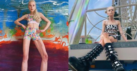 Modelka wydłużyła nogi dla męża, wydając ponad 700 tysięcy złotych. Jej kończyny mierzą 116 cm! Dziś żałuje decyzji (ZDJĘCIA)