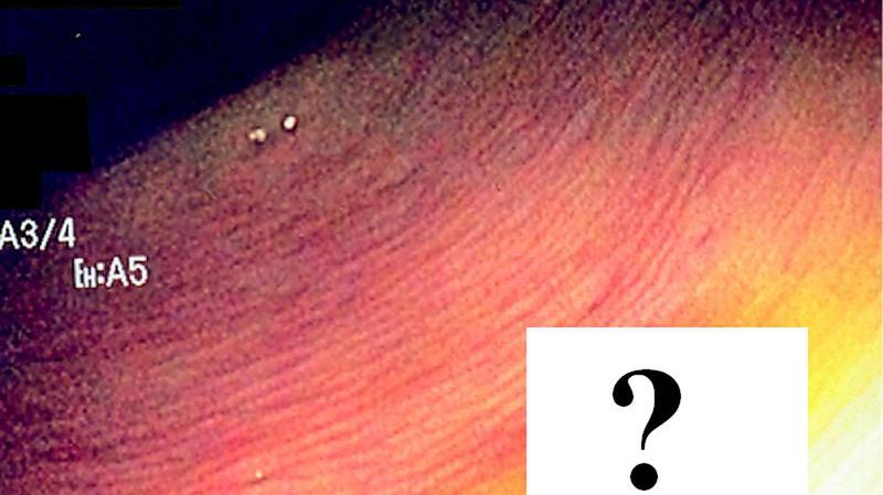 Co można znaleźć w swoim ciele? 1