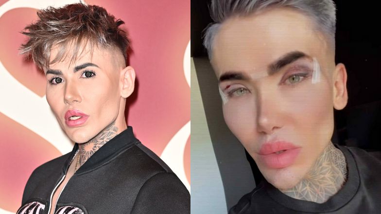 Polski "żywy Ken"  chwali się efektami blefaroplastyki powiek