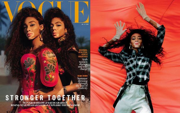 Winnie Harlow i jej "koleżanka" z bielactwem trafiły na okładkę "Vogue'a"!