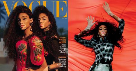 Winnie Harlow i jej "koleżanka" z bielactwem trafiły na okładkę "Vogue'a"!