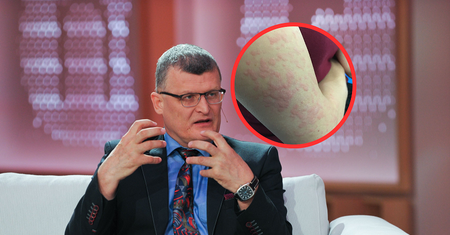 Pierwszy rodzimy przypadek Gorączki Zachodniego Nilu. Takie są objawy