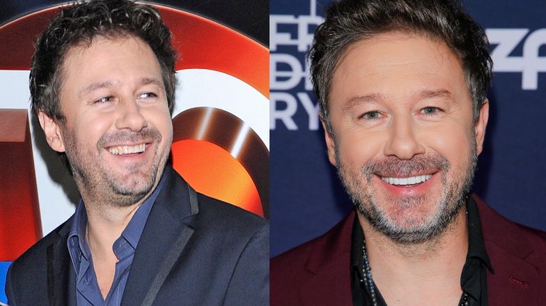 Najdroższe uśmiechy gwiazd