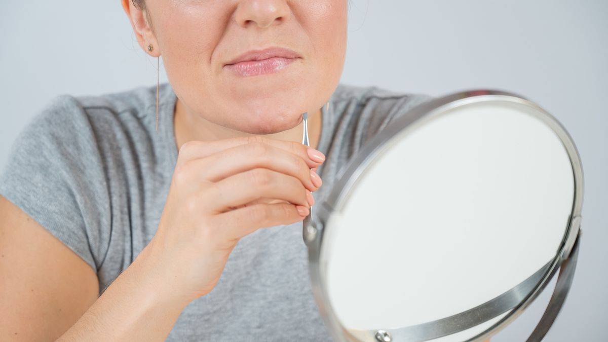 Hirsutyzm, bo tak określa się nadmierne owłosienie typu męskiego u kobiet, jest zjawiskiem występującym u około ośmiu do dziesięciu procent kobiet w wieku przedmenpauzalnym.