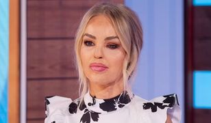 Przeszła 400 operacji po oblaniu kwasem. Obrzydliwe, co ludzie do niej mówią