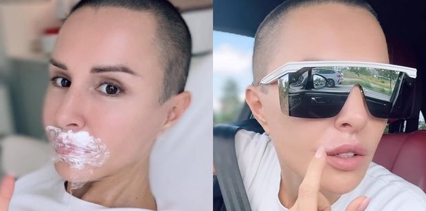 Podekscytowana Blanka Lipińska pokazuje fanom NOWE USTA: "Spójrzcie, jakie one są piękne!" (FOTO)