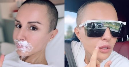 Podekscytowana Blanka Lipińska pokazuje fanom NOWE USTA: "Spójrzcie, jakie one są piękne!" (FOTO)