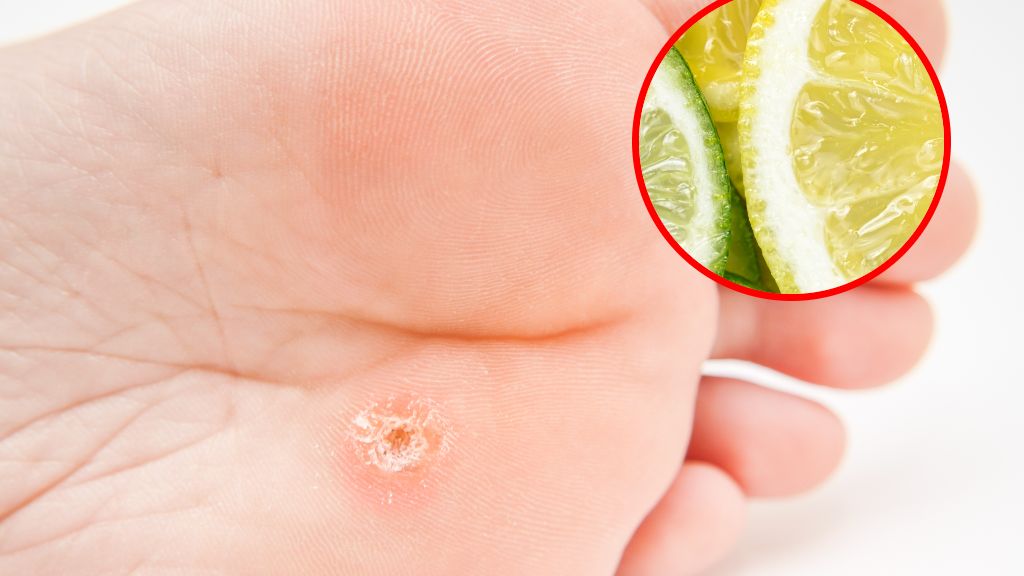 Jak usunąć odciski?