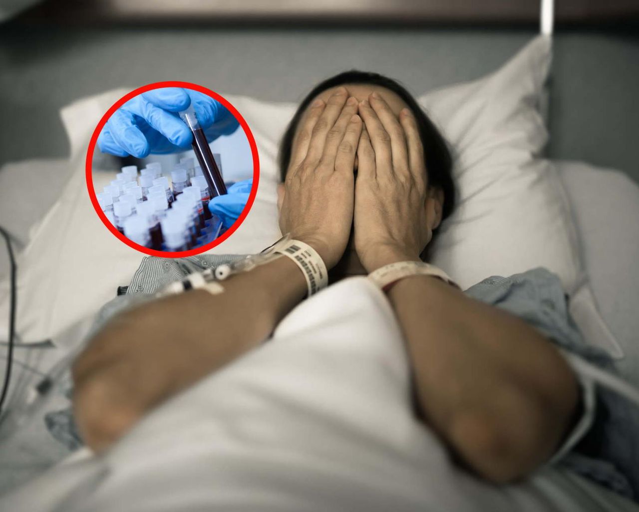 Anemia może być pierwszym objawem. Tak atakuje śmiertelny nowotwór krwi