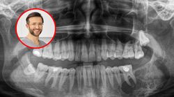 Przyszła po aparat, wykryto u niej nowotwór. Ortodonta o kulisach swojej pracy 