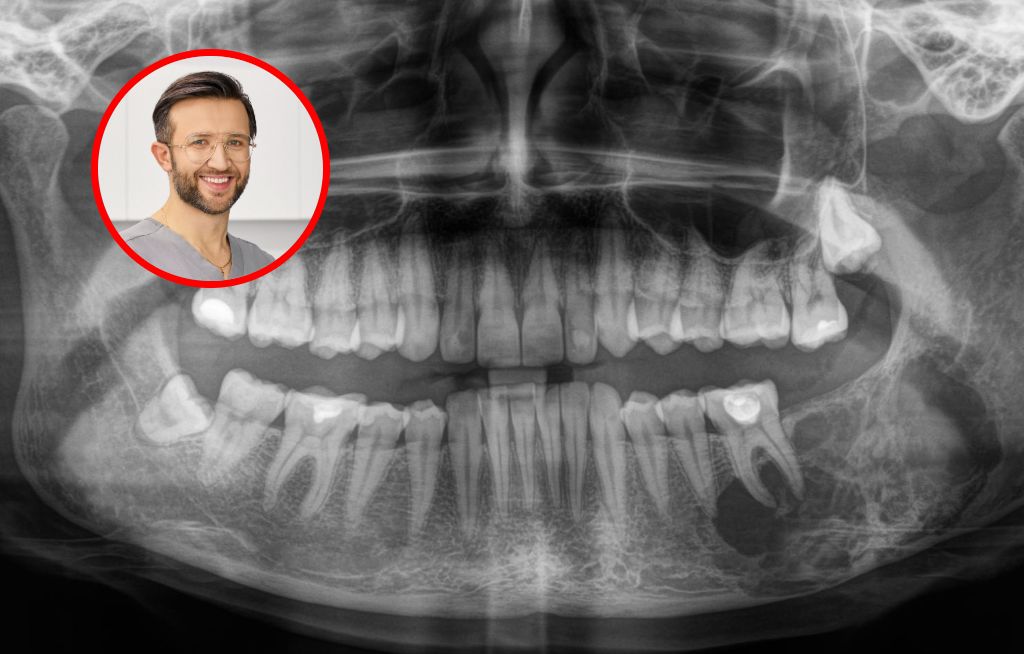 Przyszła po aparat, wykryto u niej nowotwór. Ortodonta o kulisach swojej pracy