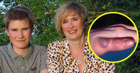 15-latek chciał dorobić. Złapał rzadkiego wirusa. Jego ciało "płonęło ogniem"