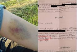 Pobili ich, bo rozmawiali o gejach. Policja umorzyła śledztwo z "braku danych"