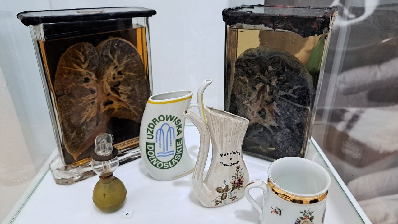 Bytom: Dawna medycyna ludowa w Muzeum Górnośląskim