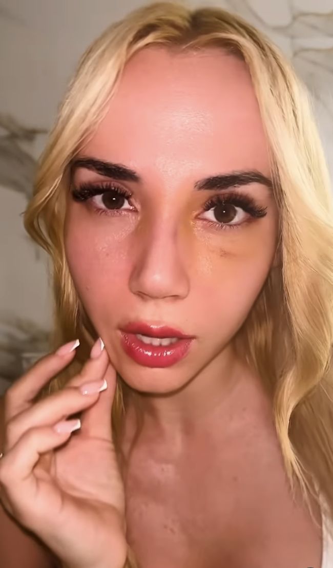 Marianna Schreiber ma nowy nos. Pochwaliła sie zdjęciem gipsu