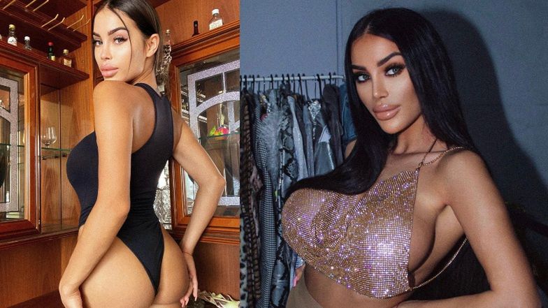 Recydywistka operacji plastycznych Wiktoria Sypucińska (tym razem) POWIĘKSZYŁA POŚLADKI