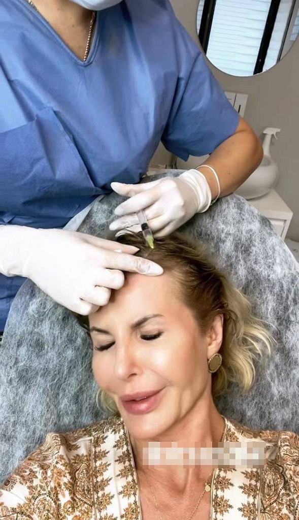 Joanna Racewicz relacjonuje bolesny zabieg na Instastories