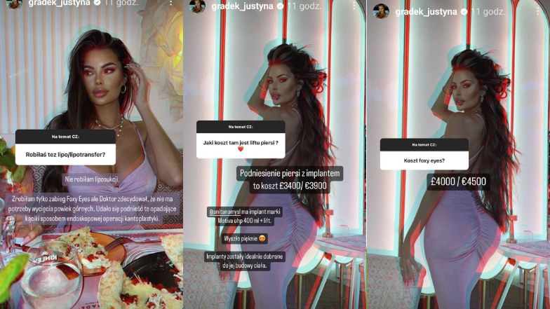 Justyna Gradek relacjonuje pobyt w tureckiej klinice. Zdradziła, na jaki zabieg się zdecydowała