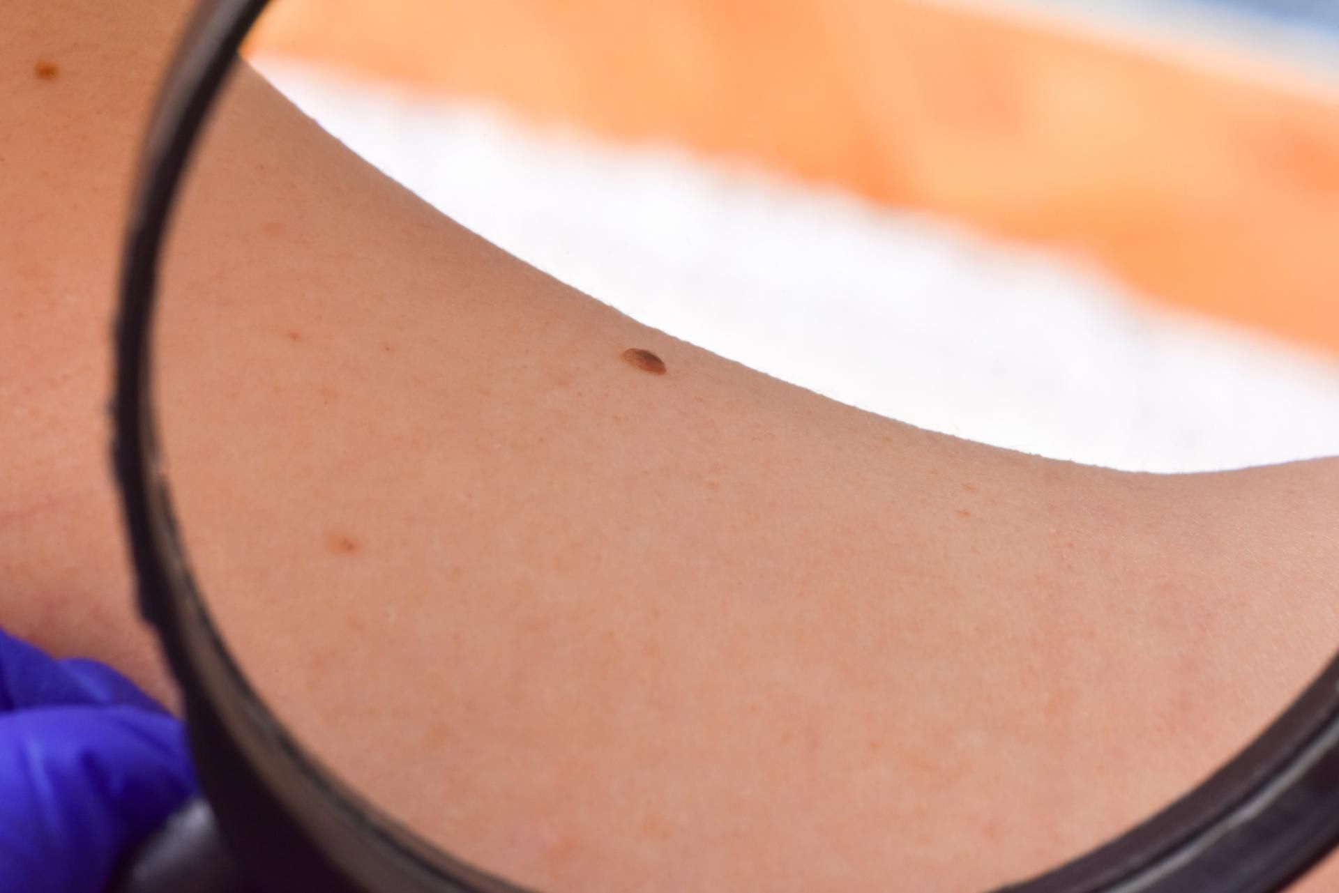 Ubrania z wysokiem filtrem UPF chronią skórę przed szkodliwym promieniowaniem