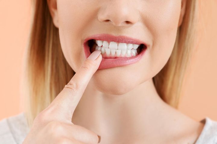 Odwapnienie zębów to sytuacja, w której szkliwo ulega demineralizacji