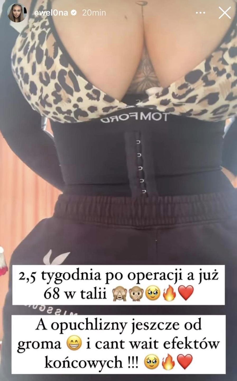 Ewel0na