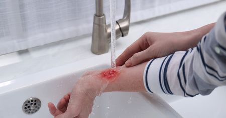 Mepilex Ag – jak i kiedy go stosować?