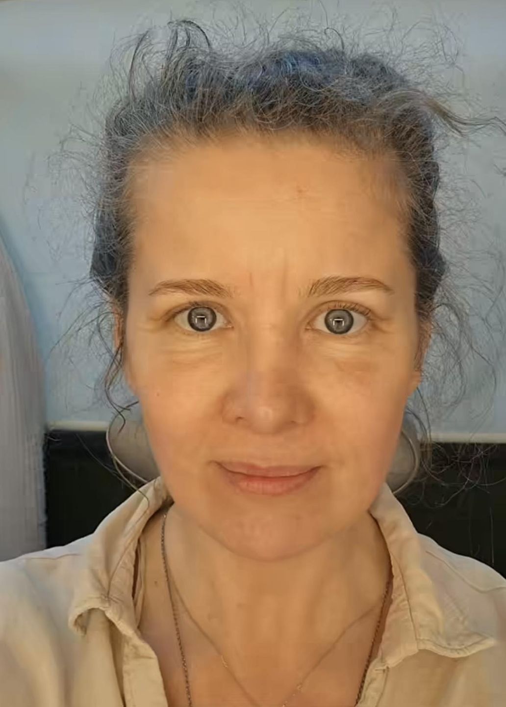 Anna Powierza wycięła nadmiar skóry na powiekach