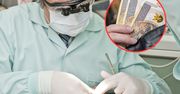 Coraz więcej Polaków zwleka z wizytą u dentysty. Powodem nie tylko wzrost cen usług
