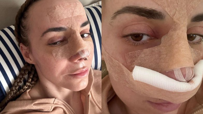 Marianna Schreiber pokazuje nowe zdjęcia po operacji plastycznej nosa, przyznając: "Nie wyglądam korzystnie" (ZDJĘCIA)