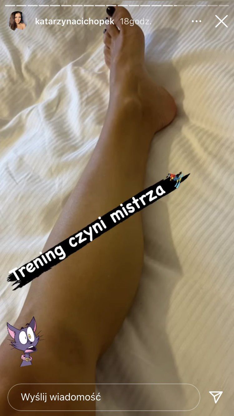 Jazda na nartach nie zakończyła się dla niej dobrze 