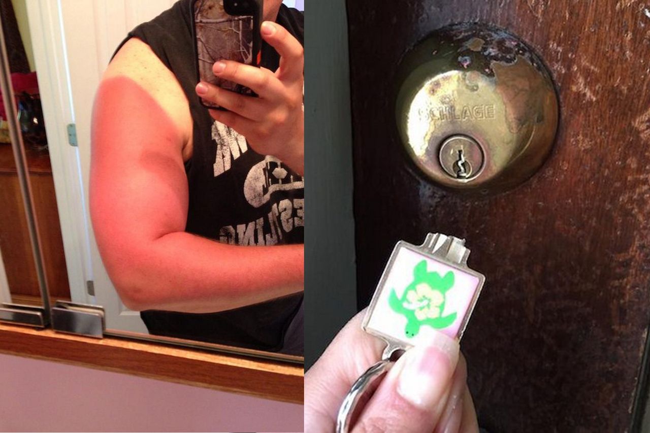 Zdarzyło ci się to kiedyś? Wiesz, jaki to ból