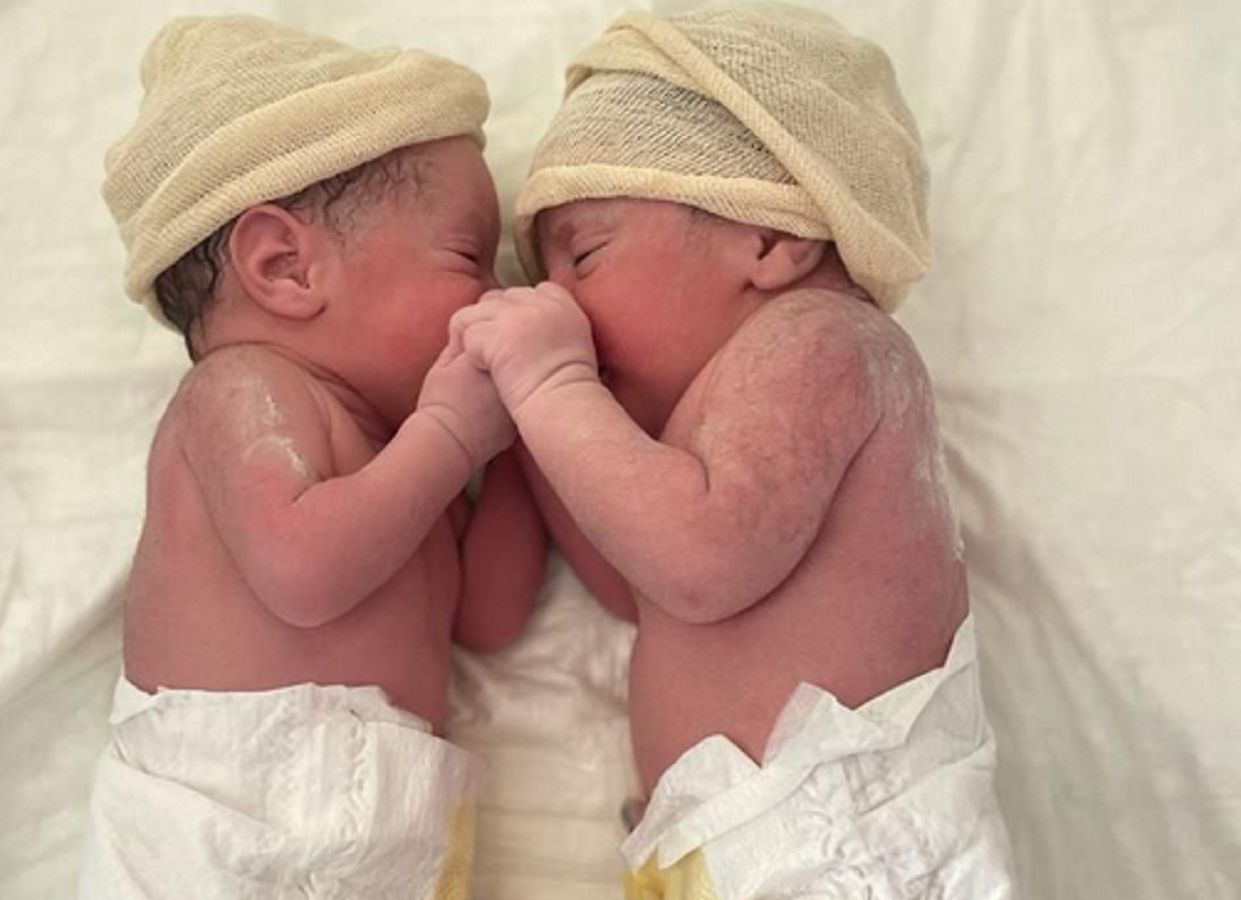 Przypadek jeden na 80 tys. urodzeń. Niezwykłe zdjęcia z porodu bliźniąt