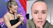 Chirurgiczna weteranka Blanka Lipińska chwali się NOWYMI USTAMI. "Nie każdy się tak świetnie goi jak ja". Zadrościcie? (FOTO)