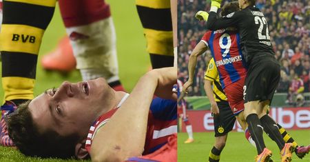 Lewandowski trafił do szpitala! Ma pękniętą kość twarzy!